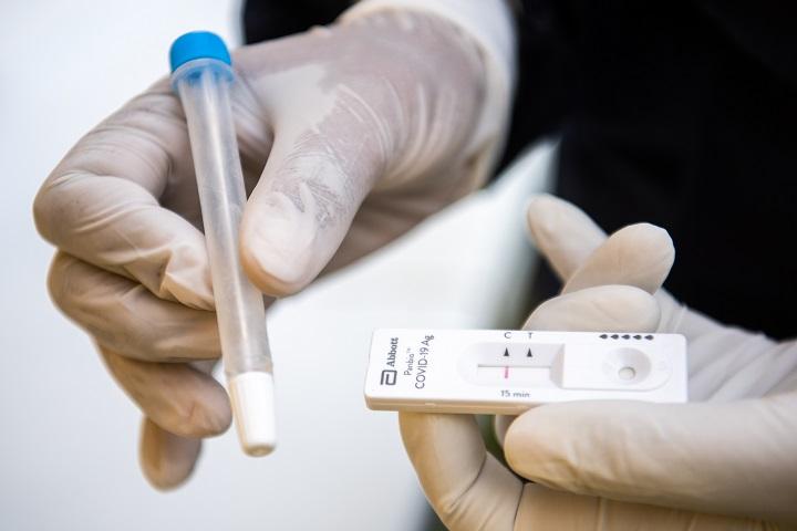 MSP recomienda Test Antig nicos como primera opci n para detectar